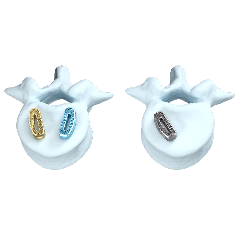 Self-Stabilizing Lateral Lumbar Interbody Fusion Cage